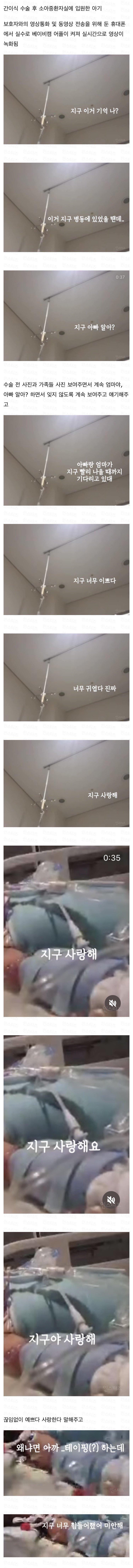 실수로 유출된 소아중환자실 영상